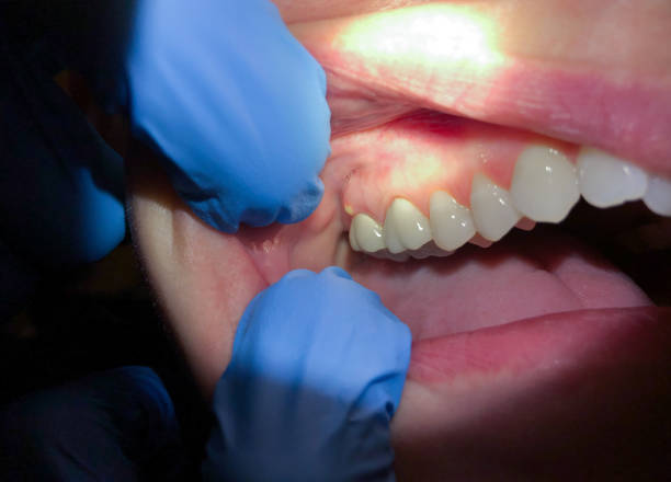 Best Emergency Dentist for Special Needs Patients in Valdez, AK